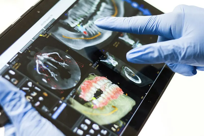 Doktor pregleda 3D snimak vilice